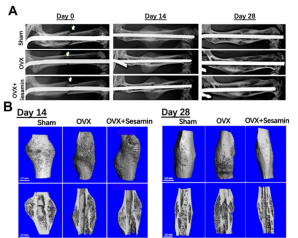Sesamin Study for Osteoporotic Fracture Healing